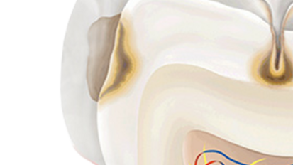 Prevent and Protect Oral Health for a Lifetime