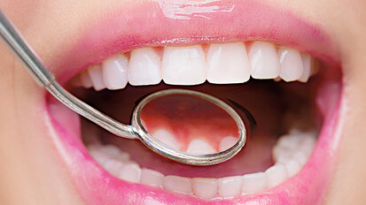 Achieving Whole Mouth Health