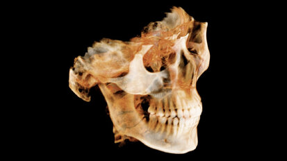 10 Radiologic diagnoses every dentist should know Part 1