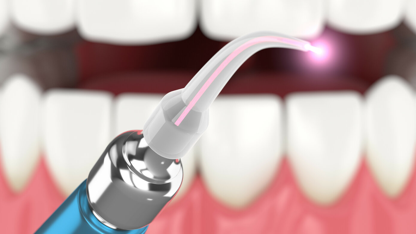 Laser Plumes – More Than a Puff of Smoke