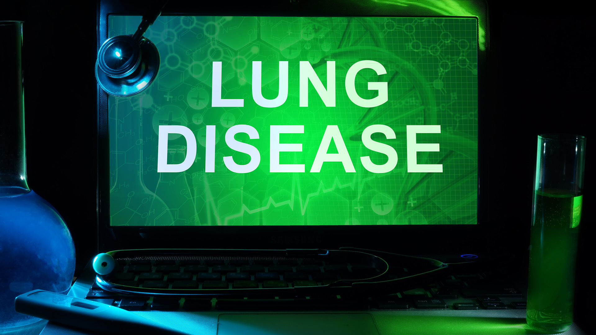 Dentistry & Health Care Idiopathic Pulmonary Fibrosis: A Newly-identified Occupational Hazard for Dentists Dentistry & Health Care Idiopathic Pulmonary Fibrosis: A Newly-identified Occupational Hazard for Dentists