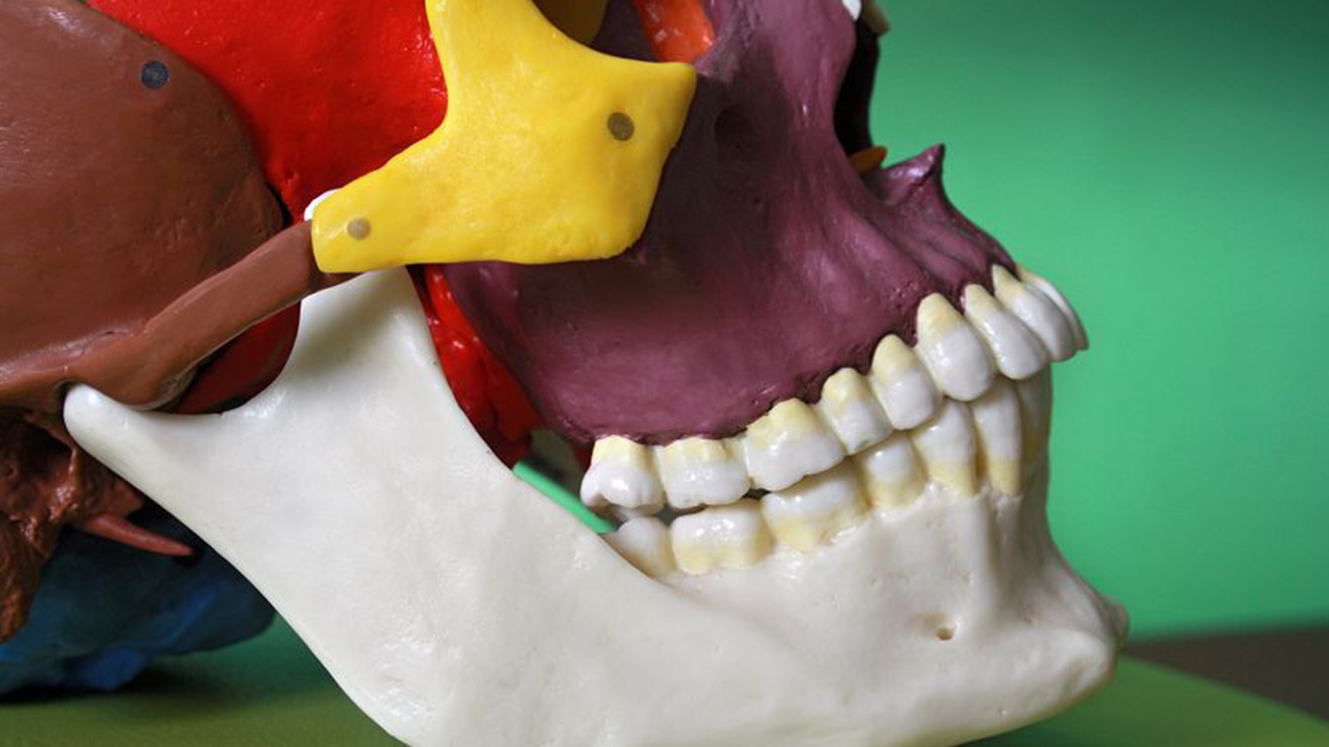 Conservative Management of Temporomandibular Joint Dysfunction Conservative Management of Temporomandibular Joint Dysfunction