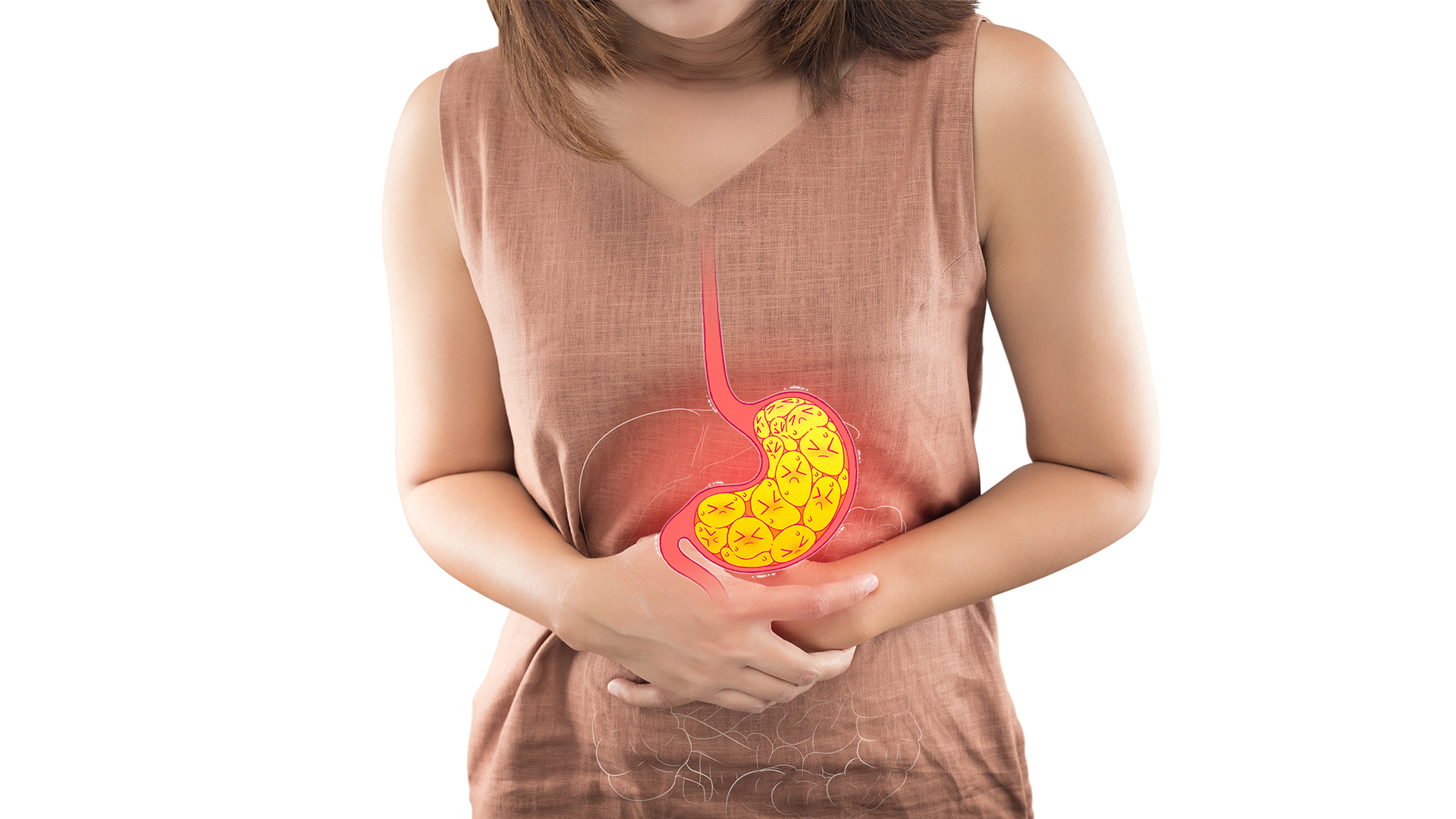 Gastroesophageal Reflux Disease: Implications and Management Gastroesophageal Reflux Disease: Implications and Management