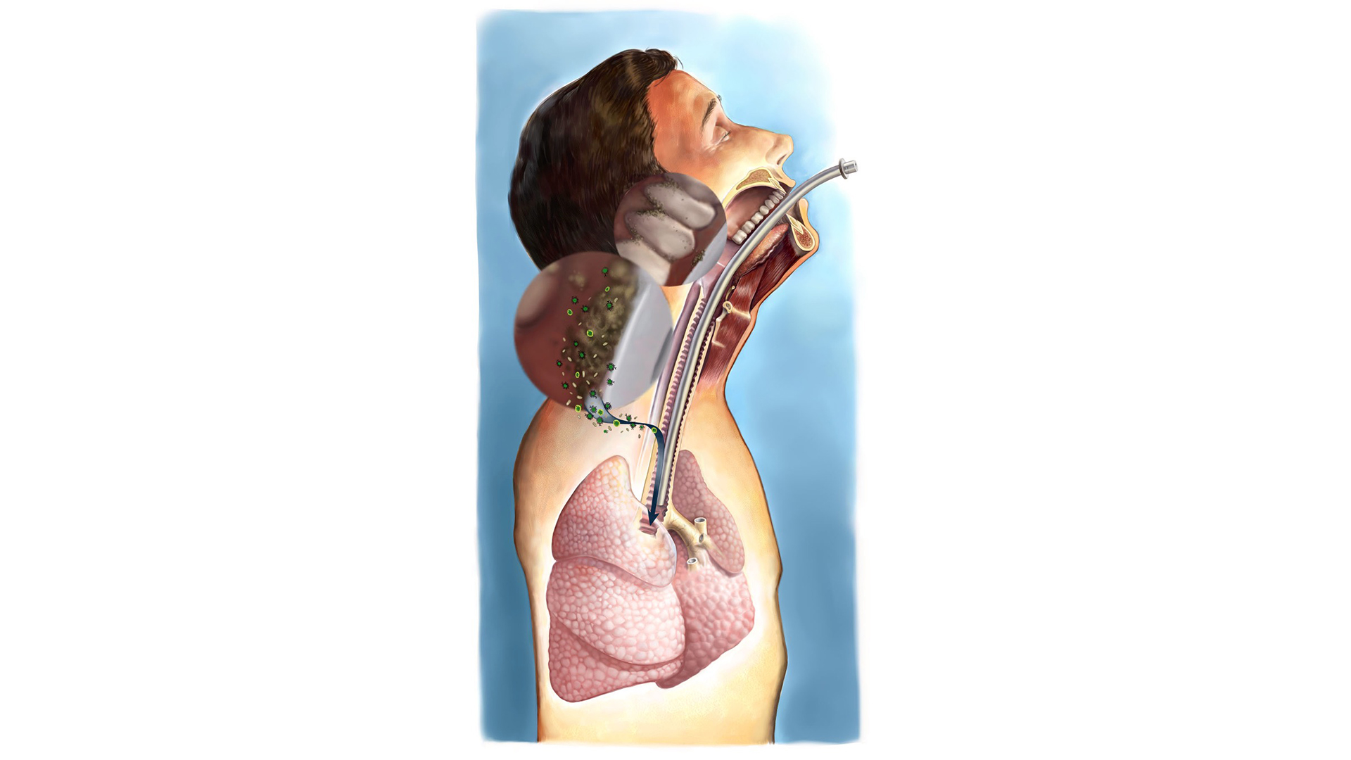 The mouth and the body: The Influence of Oral Health on Pulmonary Diseases The mouth and the body: The Influence of Oral Health on Pulmonary Diseases