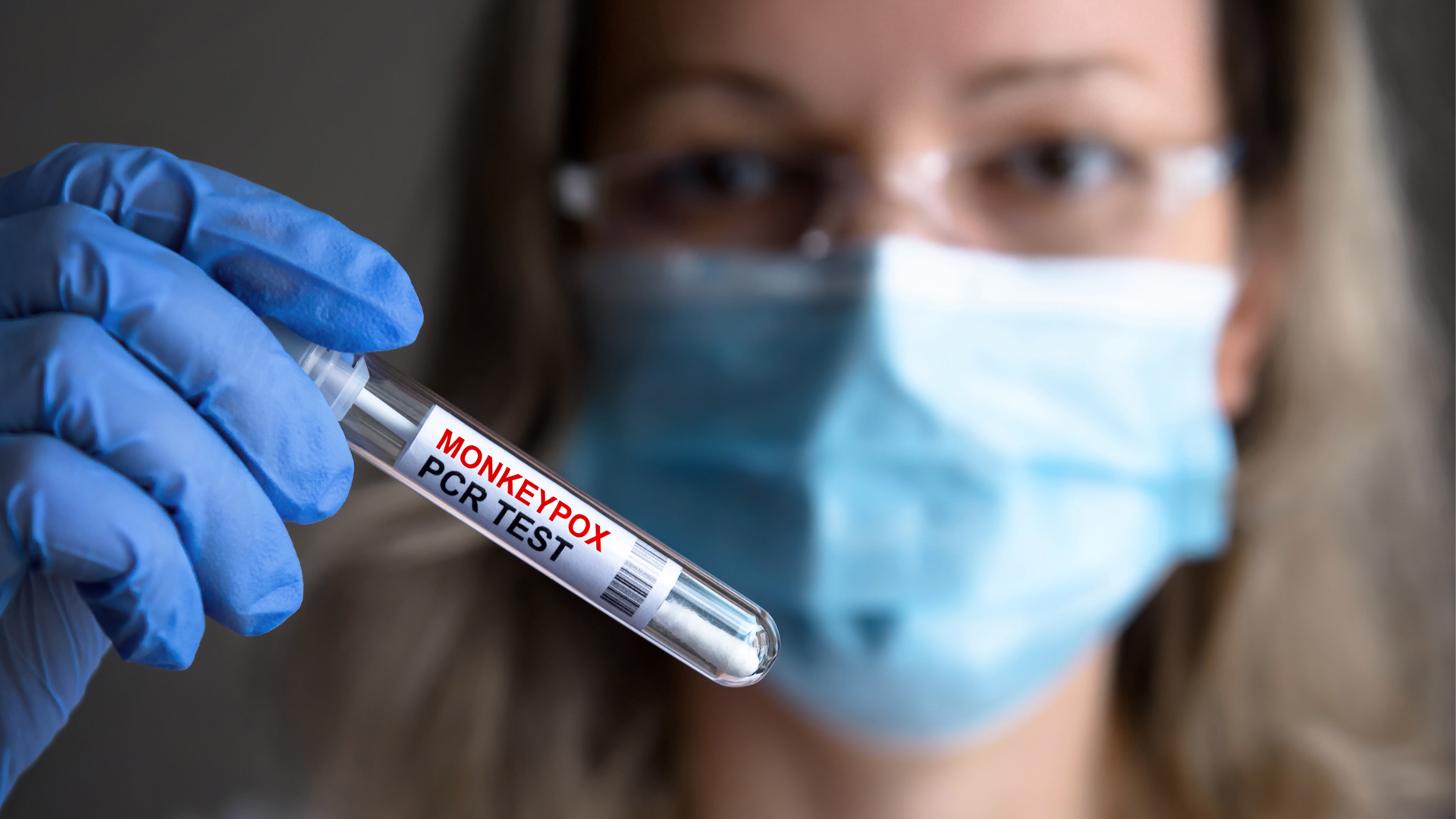 Monkeypox: What we need to know