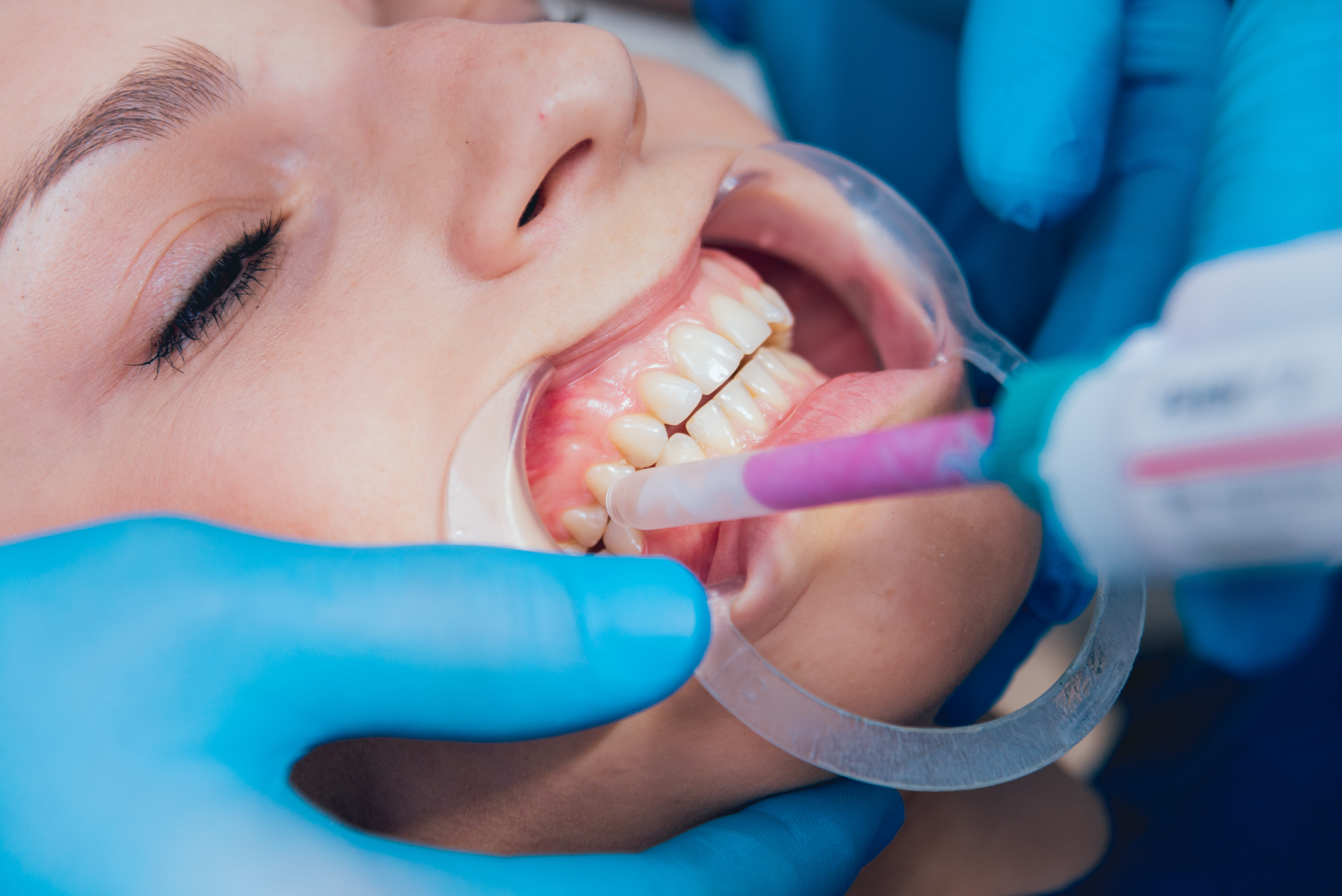 Occlusion, Mastication and Cognitive Function Occlusion, Mastication and Cognitive Function