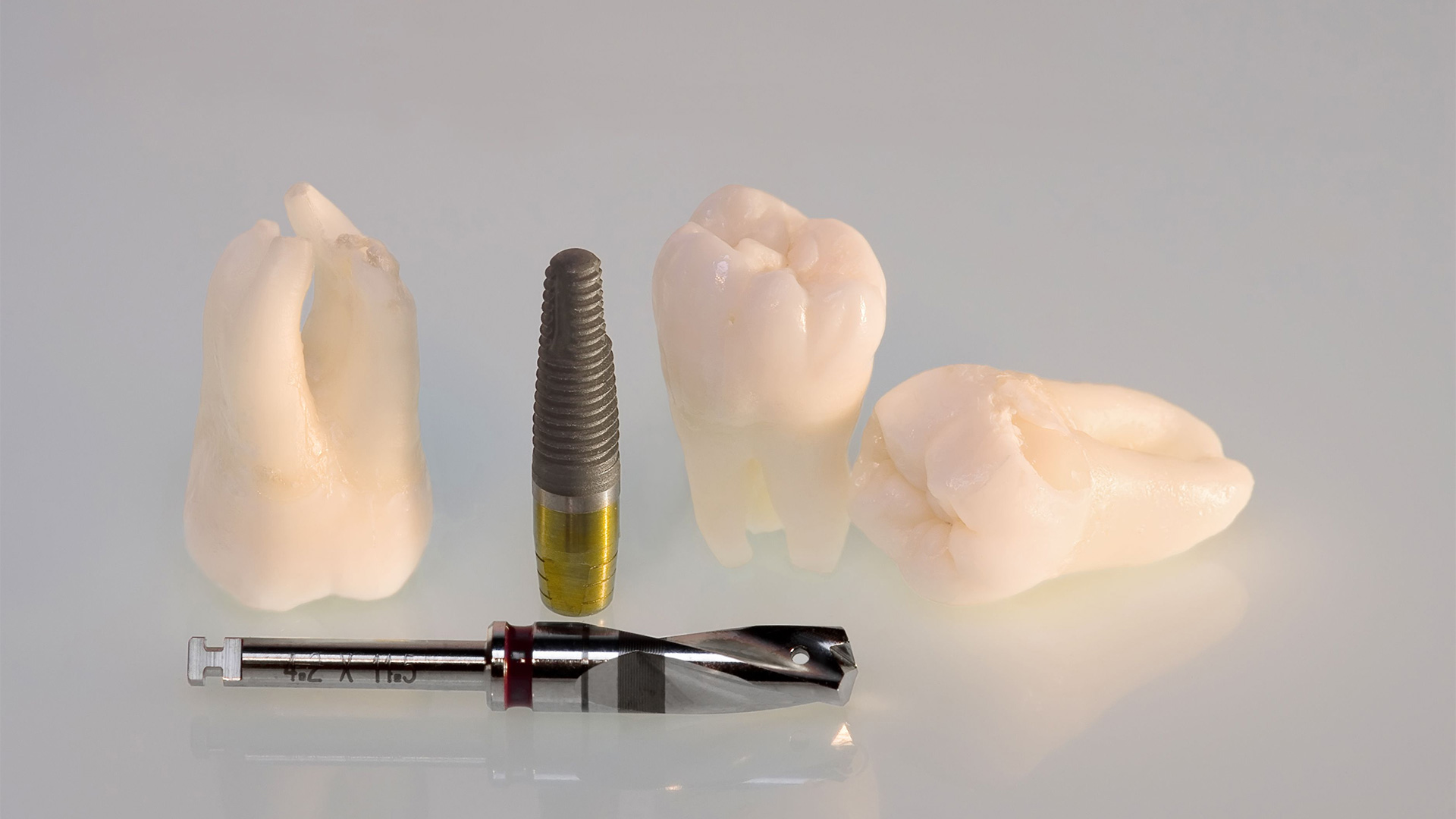 Tooth Retention vs. Tooth Extraction and Implant Placement Tooth Retention vs. Tooth Extraction and Implant Placement