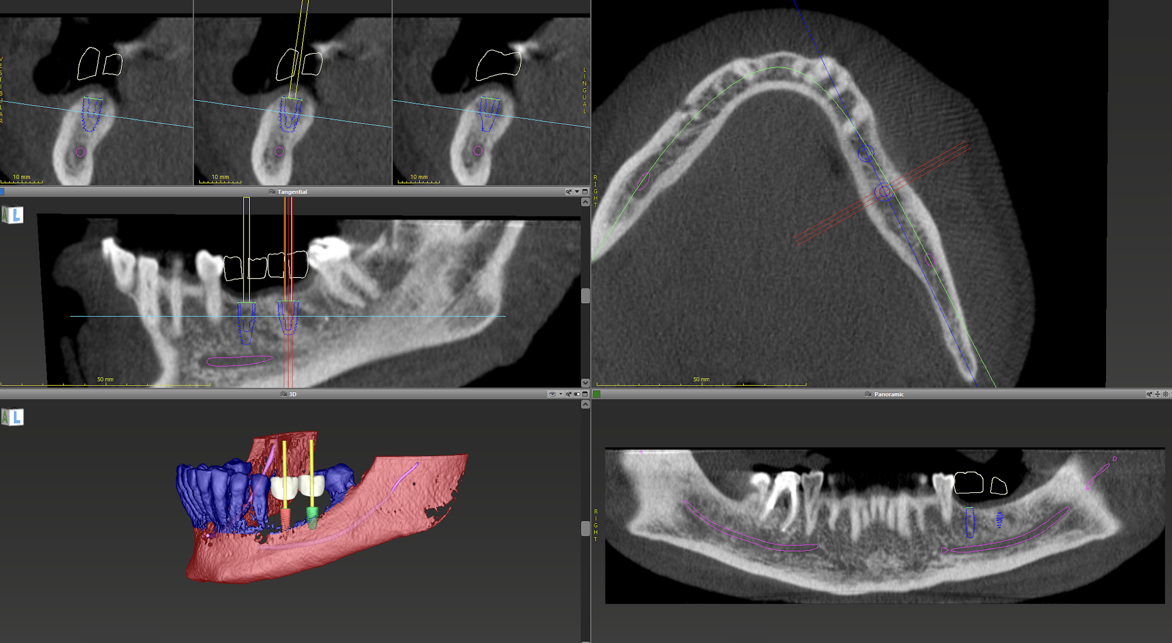 Use of Cone Beam Computed Tomography in Dentistry