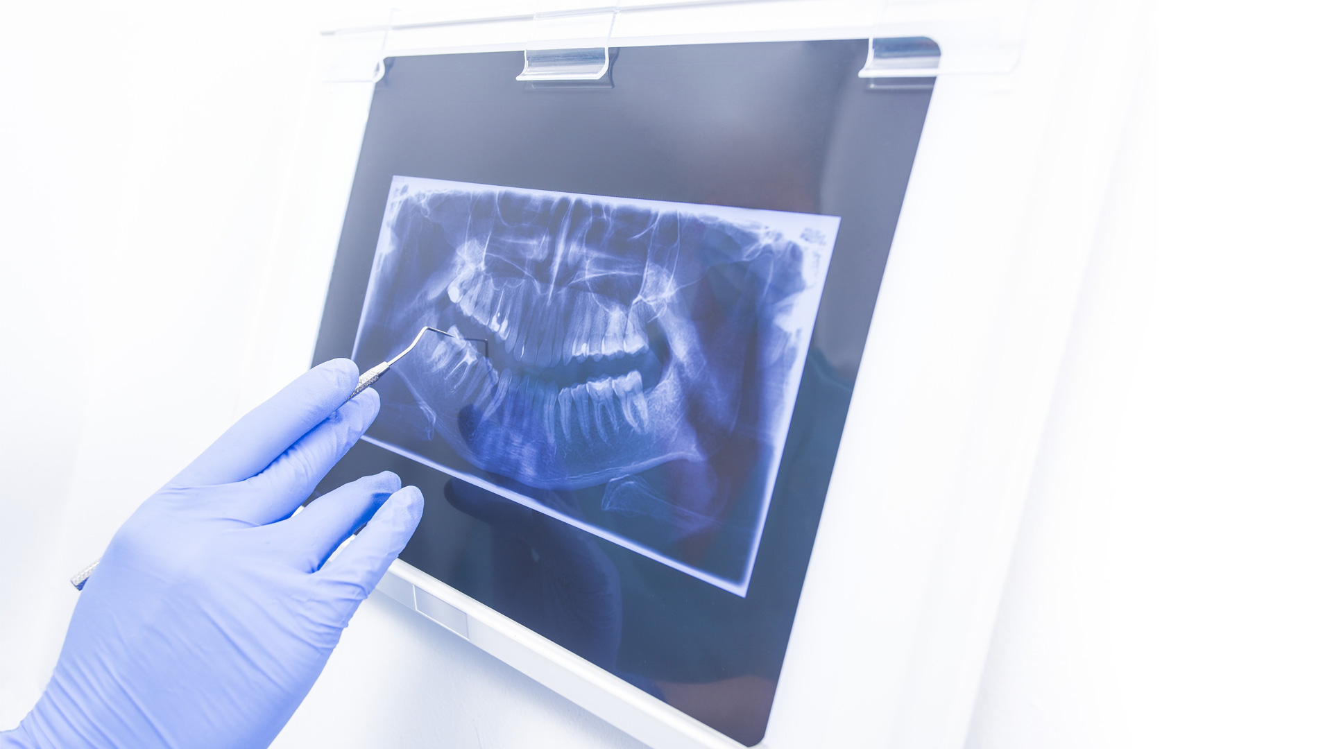 Critical Value of Panoramic Films