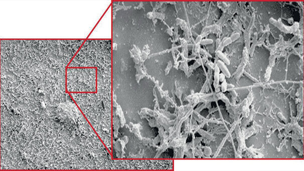 Quando l’infezione rientra fra i rischi lavorativi e assistenziali dello studio odontoiatrico