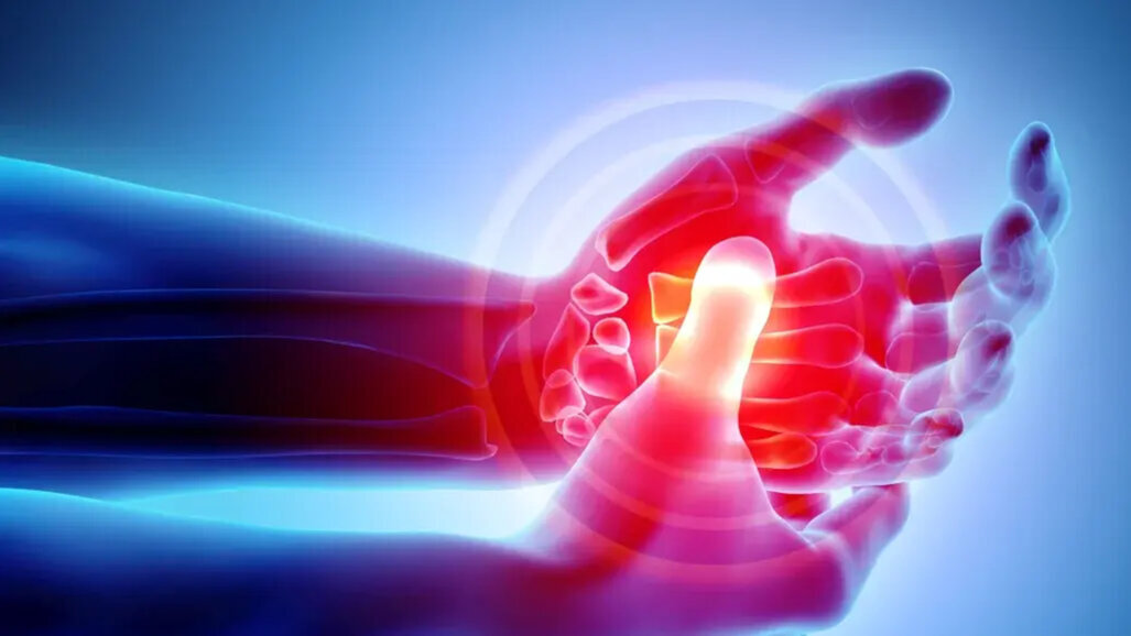 Periodontal disease more common in patients with rheumatoid arthritis