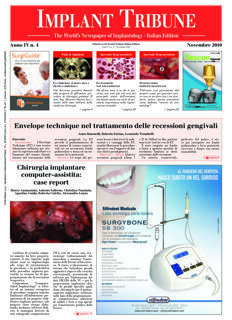 Implant Tribune Italy