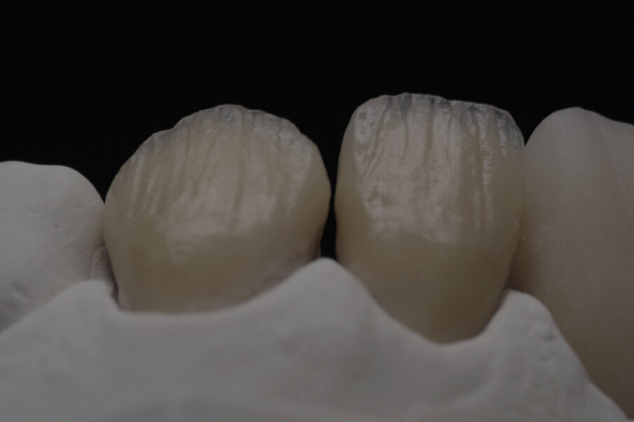 Fig. 27: Internal texture.