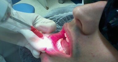 Laser vs traitements classiques