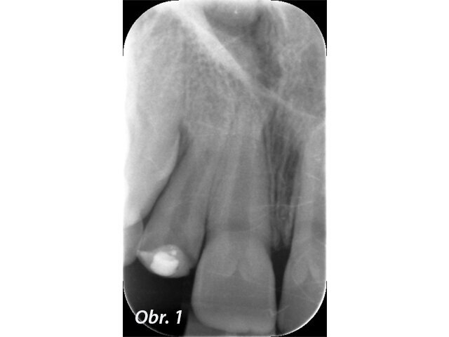 Obr. 1: Stav při vyšetření (2011)
