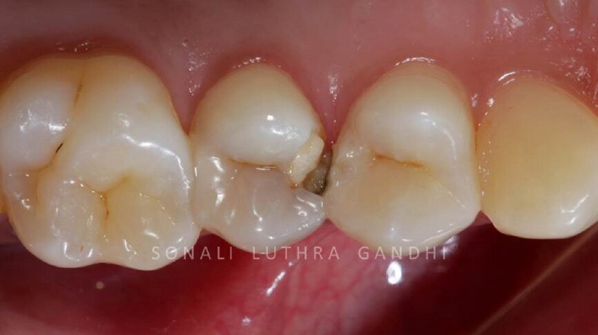 Figure 1 Pre-operative photograph