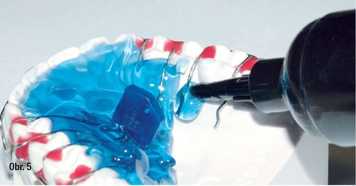 Postup práce s Orthocryl LC