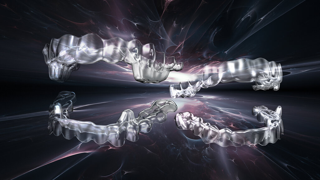 Smartee’s new S8 clear aligners correct severe Class II malocclusion
