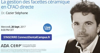 Webinaire : La gestion des facettes céramique en CFAO directe ».