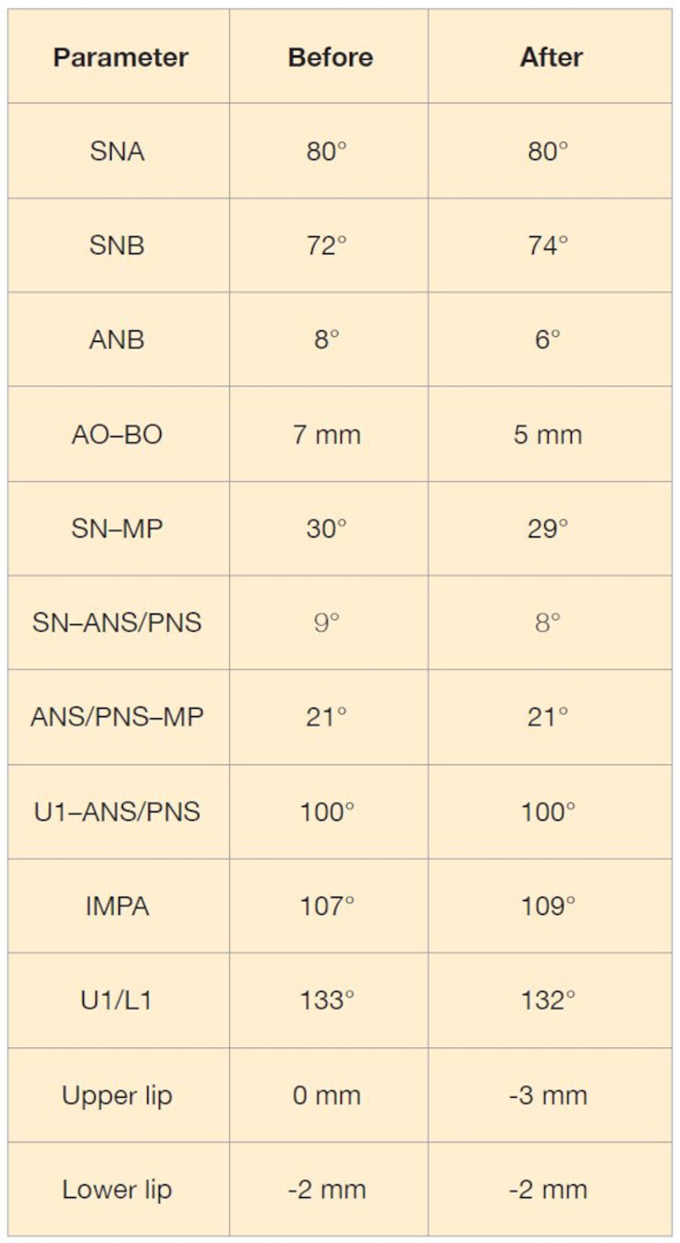 Table 1: Cephalometric data before and after treatment.