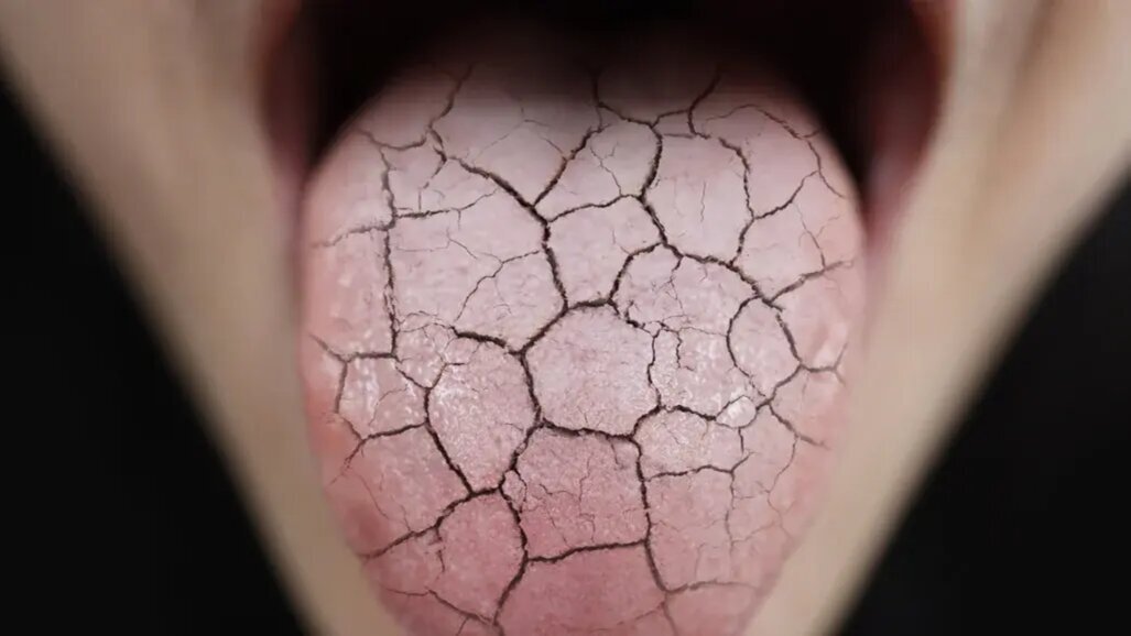 “Estamos pensando além da odontologia”: estudo ajuda médicos a identificar a síndrome de Sjögren