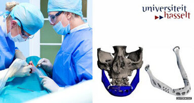 Erstes Kiefertransplantat mit 3D-Drucker hergestellt