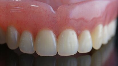 Nouvelle étude sur la qualité de vie des patients porteurs de prothèses et d’implants dentaires