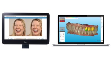 Align Technology presenta innovazioni per l’ecosistema digitale iTero e l’esperienza del paziente