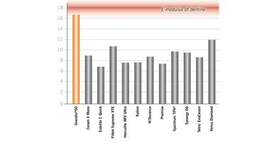 Μέτρο ελαστικότητας όμοιο με του δοντιού – ασφαλέστερη αποκατάσταση!
