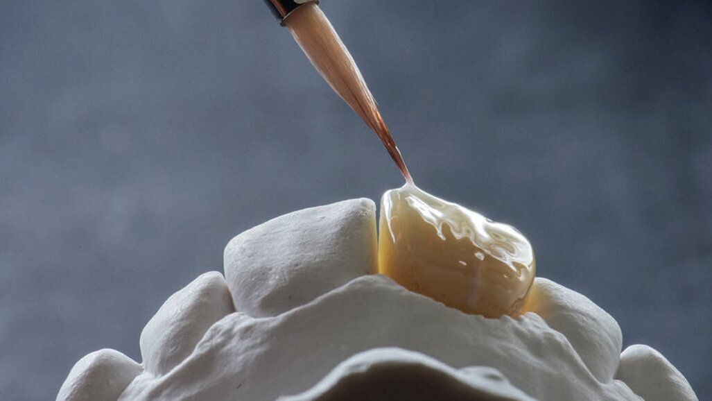 Micro-layering: A new era in porcelain layering