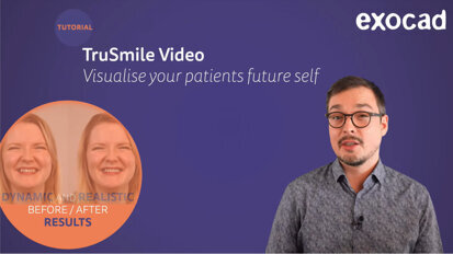 exocad – TruSmile Video – Realistic Makeover Visualizations for Smile Creator