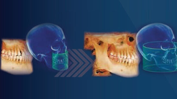 i-CAT FLX V-Series: A CBCT solution that can grow with your practice