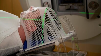 Una buona salute orale è associata a una migliore sopravvivenza nei pazienti affetti da tumore del distretto testa-collo