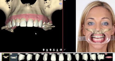 ¿Qué convierte a un Ortodoncista en Experto? (Parte II)