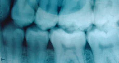 Dental tissue engineering products in the US market to double by 2015