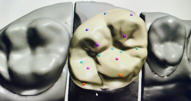 Modelacija krunice - manuelno ili digitalno?