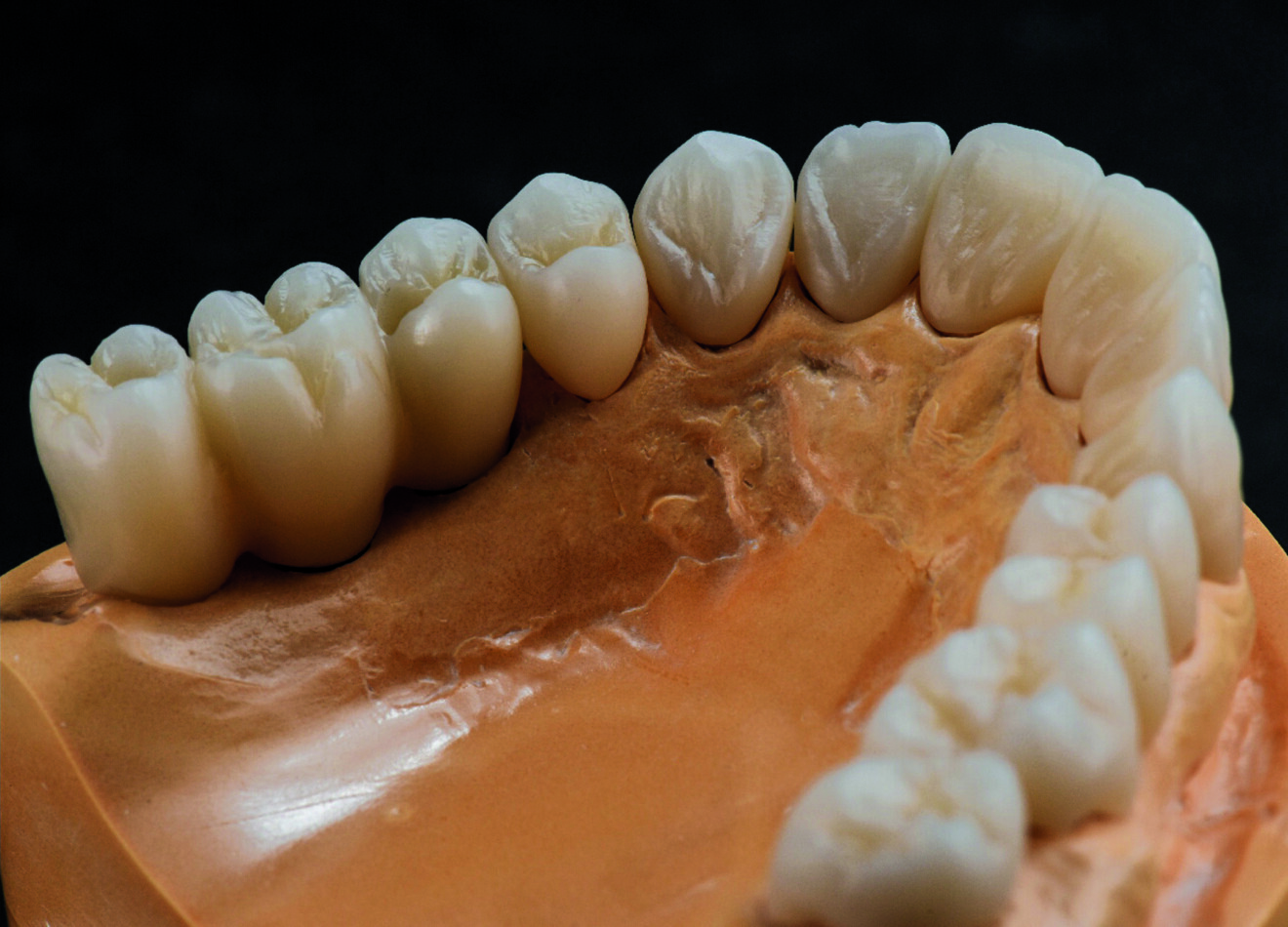 Fig. 7b : La structure de la surface est encore visible après le frittage. 