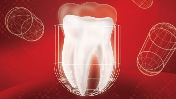 Endo's soms overbodig door vervanger natuurlijk dentine