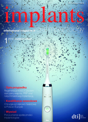 implants Poland No. 1, 2012 implants Poland No. 1, 2012