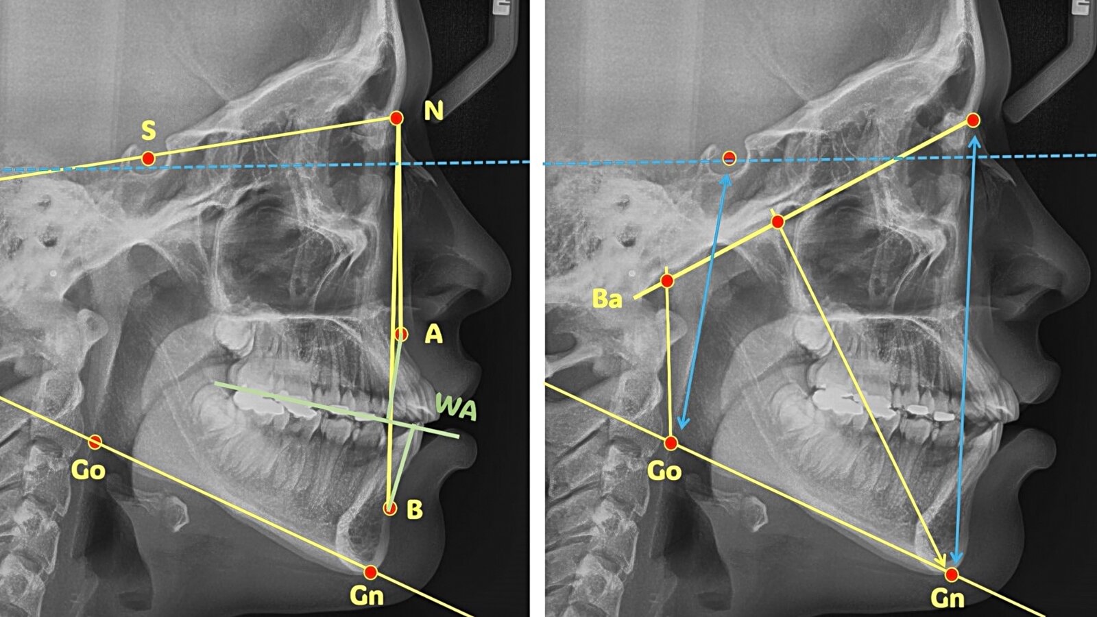 La cefalometría debe contestar las siguientes preguntas