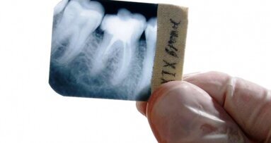 Carestream Health podwyższa ceny filmów do badań radiologicznych