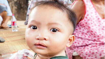 Digitales Verfahren zur einfacheren Behandlung von Fehlbildungen Digitales Verfahren zur einfacheren Behandlung von Fehlbildungen