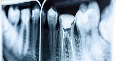 Vrhunska tehnologija za jednostavnost