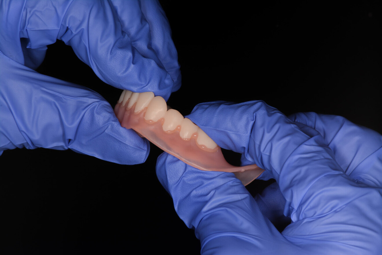 Fig. 10: Inserting the tooth segments into the filled denture bases.