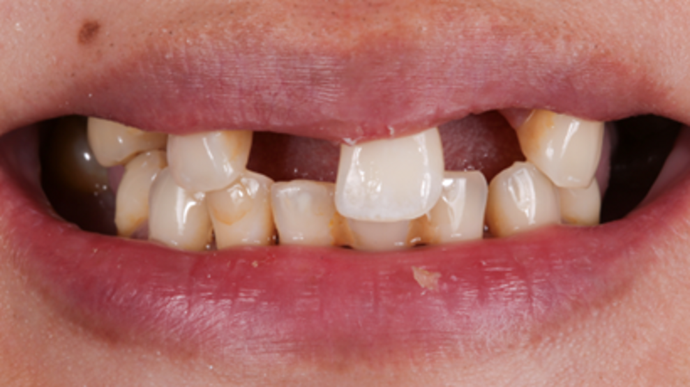 Fig. 1: Initial situation.