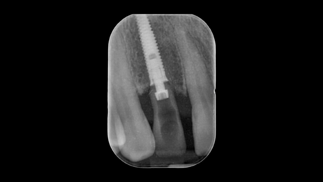 Fig. 6