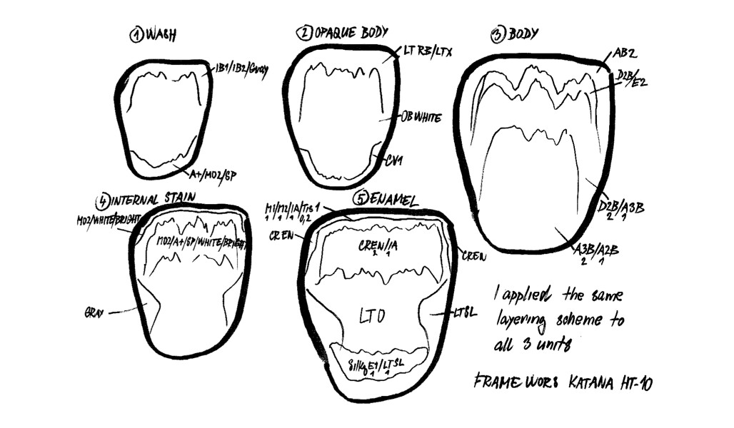 Fig. 4: Layering map for the use of CERABIEN ZR on all three crowns.