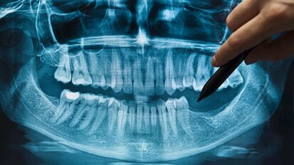 Herziene richtlijn Tandheelkundige radiologie open voor commentaar