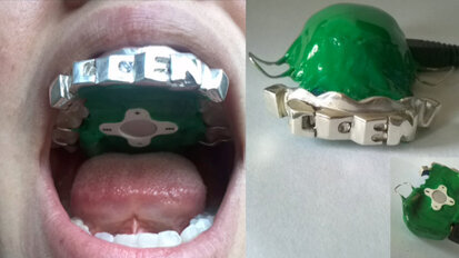 Il primo lettore MP3 dentale sviluppato da uno studente di design