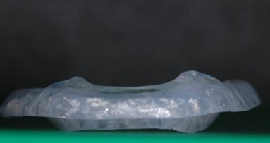 Variazioni della funzione visiva e dell’appoggio podalico in pazienti con disfunzioni cranio-cervico-mandibolari, trattati con riposizionamento mandibolare in avanzamento